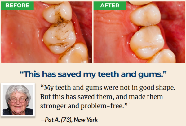 Proxental Customer Review